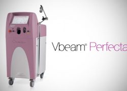 VBeam Perfecta (Dye Laser), Tratamento Com Laser De última Geração Para Lesões Vasculares